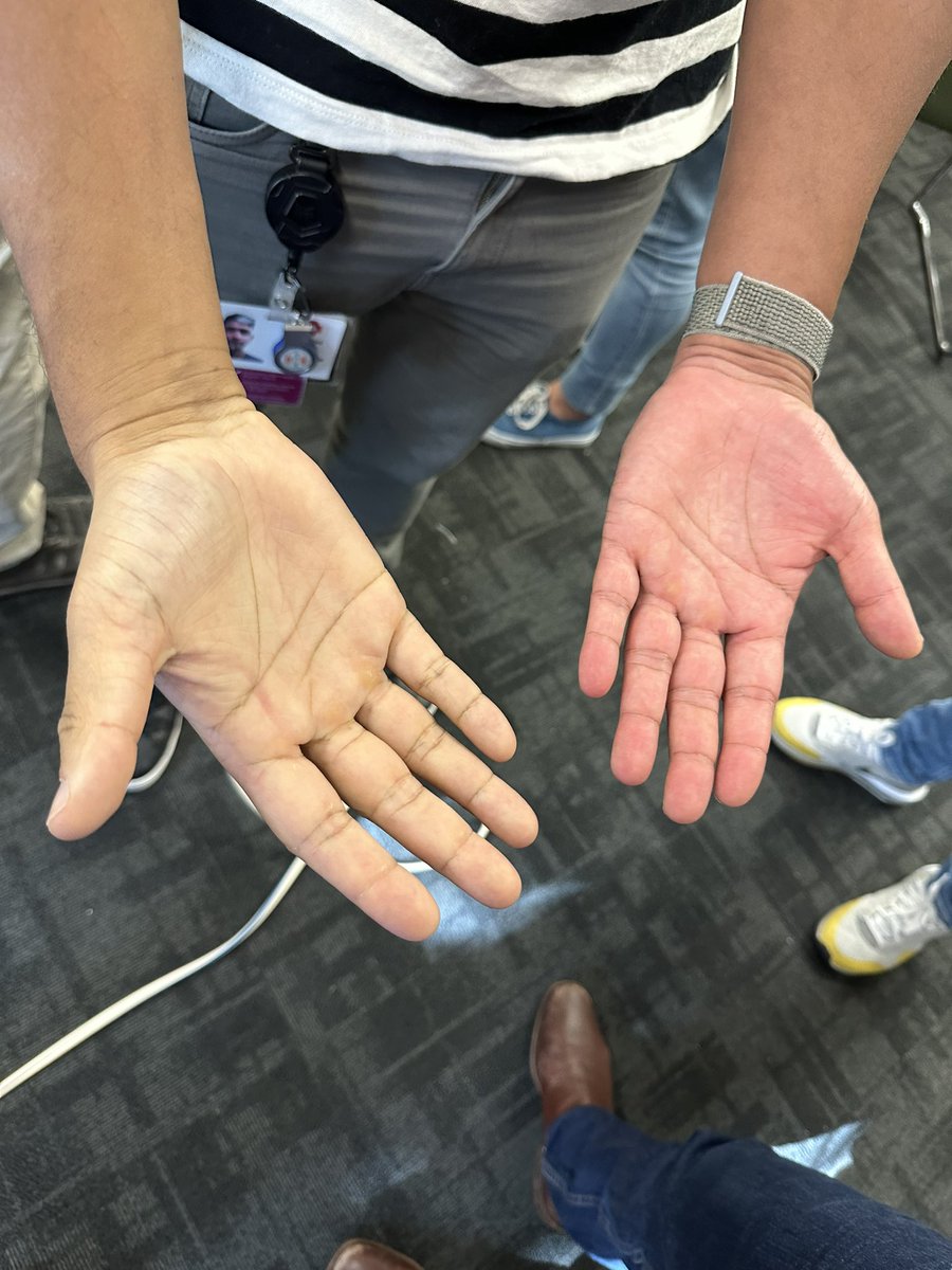 Fracture manipulation and Bier’s block education session in Advanced Group!  <a href="/EmergEdu/">Alfred Emergency Academic Centre</a> <a href="/AlfredHealth/">The Alfred</a> <a href="/dmccreary85/">Dave McCreary</a>