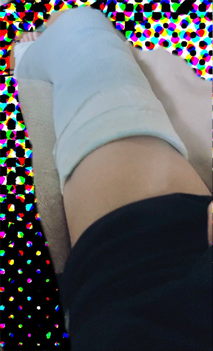 JfG4l's tweet photo. #骨折　#ギプス　#石膏　#legcast #castfetish https://t.co/vf2fF4exSh