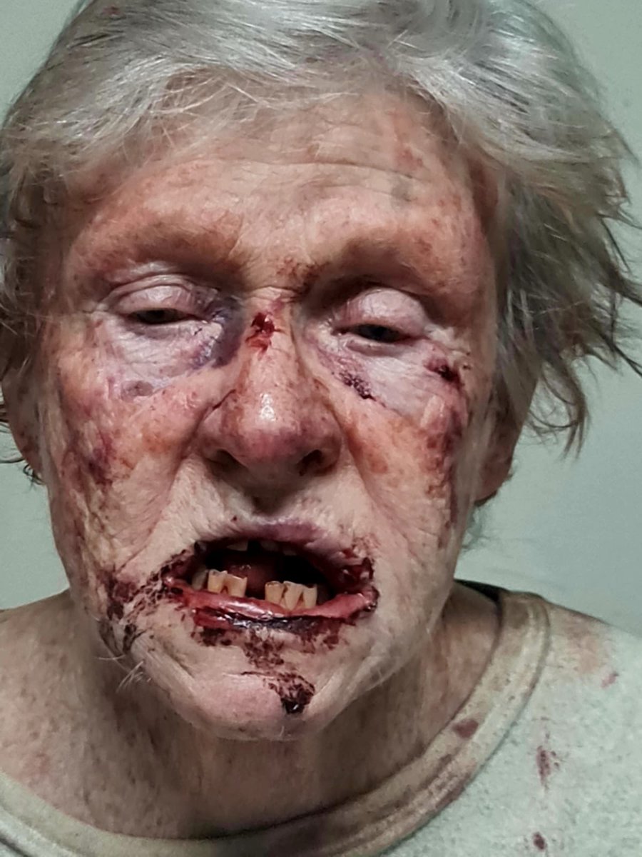 Barely 24 hours before #WomensDay, two elderly ladies were brutally attacked on farms in Mpumalanga. This is Adele Kimble (75), she was attacked in Uitkyk just outside Nelspruit.