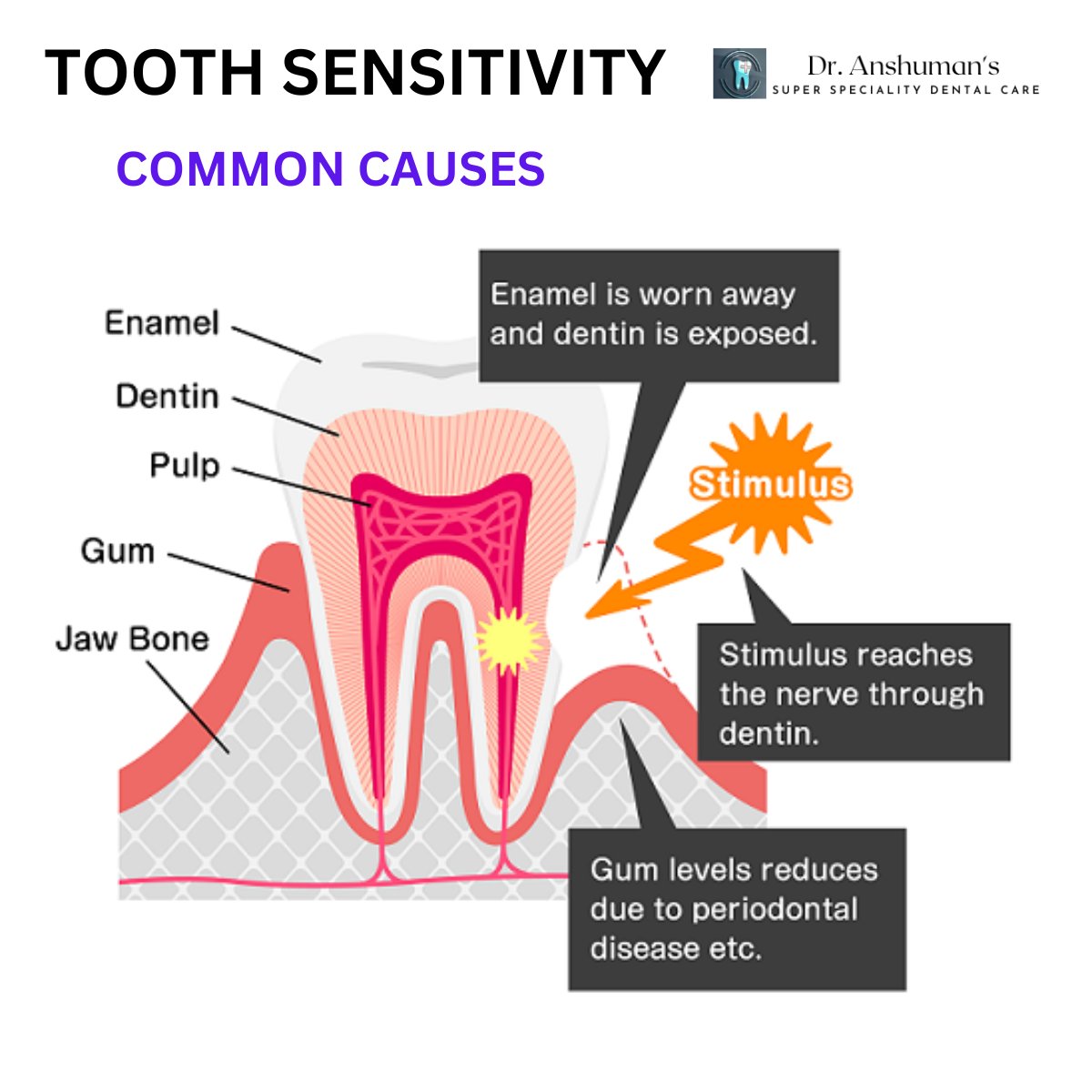 AnshumanSuper's tweet image. Teeth can become sensitive when enamel, their protective top layer, becomes worn down.

Dr. Anshuman's Super Speciality Dental Care, Satya Vihar, Bhubaneswar, Call: 7008414181

#toothdecay #sensitivetooth #dentalcare #dentalhealth