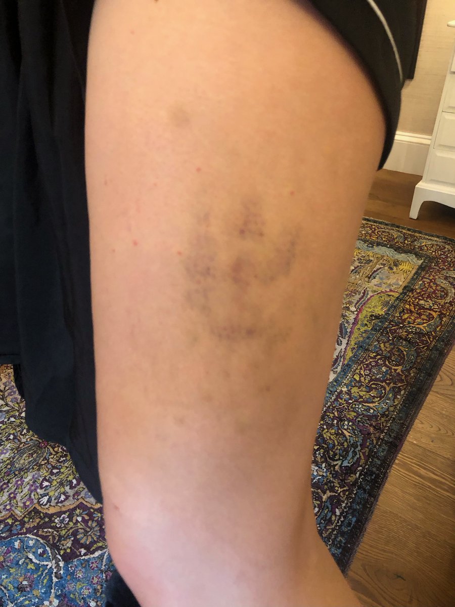 City of the Dead tweet media