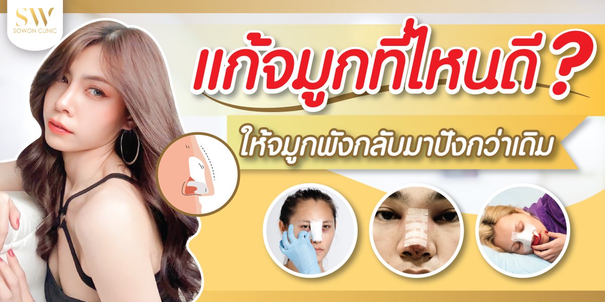 SowonClinic's tweet photo. แก้จมูกที่ไหนดี ให้จมูกพังกลับมาปังกว่าเดิม
#แก้จมูก #รีวิวแก้จมู�� #sowonclinic
อ่านเพิ่มเติม
https://t.co/Gnqs9Ct8Bk https://t.co/zSspLHhA1e
