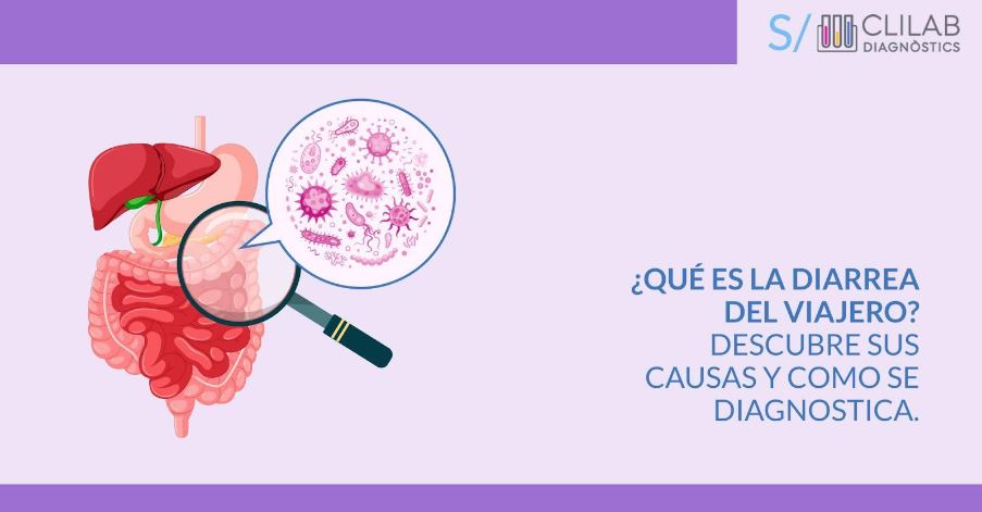 ClilabDiagnos's tweet photo. Abrimos hilo: 🌐🧫🦠 ¡Conoce más sobre la Diarrea del Viajero (DV)! 🌐🧫🦠 https://t.co/wiQBxSkvXb