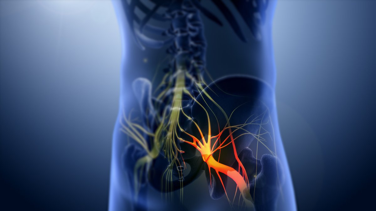 ReseaproJDRM's tweet photo. 𝐍𝐞𝐫𝐯𝐞 𝐍𝐮𝐢𝐬𝐚𝐧𝐜𝐞𝐬: Diabetes can wreak havoc on nerves, causing peripheral neuropathy. Tingling, numbness, and pain are unwelcome companions for many. [3/7]

#nerve #nervedamage #nerveweakness #nervepain https://t.co/mCXOg3vuB4