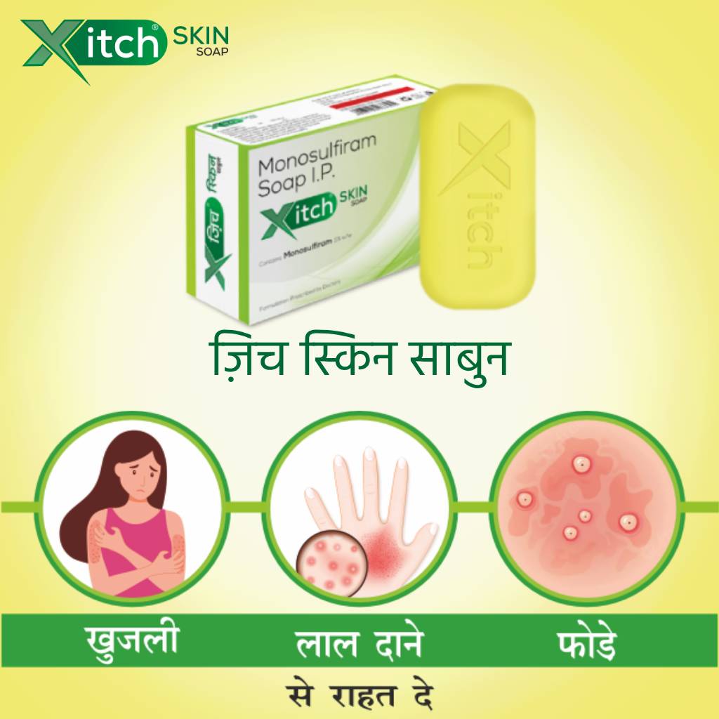 XitchRelief's tweet photo. Xitch Skin Soap (ज़िच स्किन साबुन) is the perfect solution for itchy and irritated skin. It helps to soothe and calm redness and irritation, while providing relief from itching and rashes. 
Buy Now at Amazon : https://t.co/SmocuhhpXz
#Xitch #SkinSoap #itchrelief #Monosulfiram https://t.co/izHbL3taup