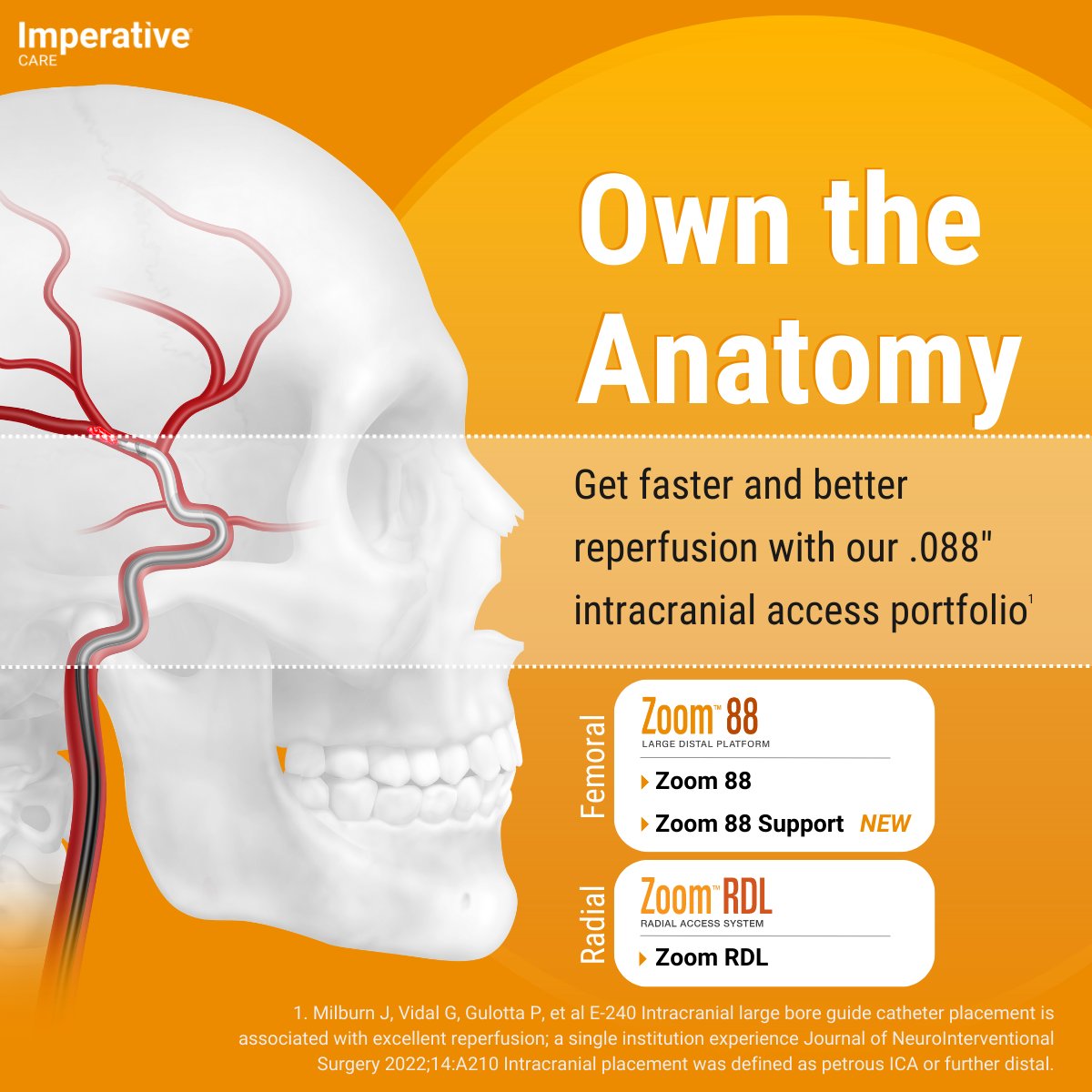 ImpCare_Stroke's tweet photo. #DYK that .088” intracranial guide catheter positioning can lead to better and faster reperfusion? Our .088” intracranial access portfolio now includes #Zoom88 Support, providing the same benefits of intracranial access found with Zoom 88 + #ZoomRDL, with the ability to treat a broader stroke patient population.
#ZoomStrokeSolution
Rx only. ISI: https://t.co/20ZwfceFWm