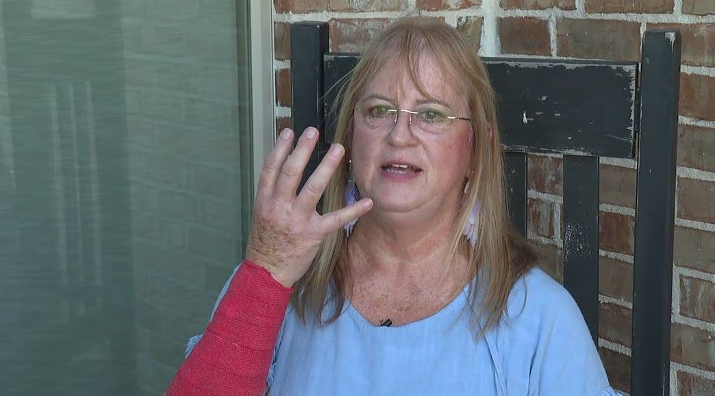 WAFB's tweet photo. GRAPHIC: Hawk drops snake on Texas woman; both animals attack her: https://t.co/XuOxZE4B9L https://t.co/bpJvMxRKW7