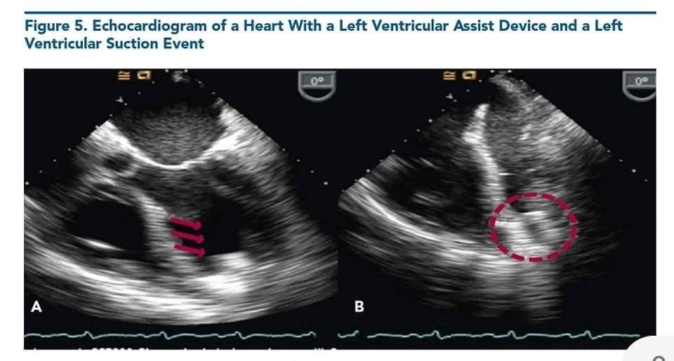 LeslieMegom's tweet photo. 🏥🚨🚨Avances en la reanimación cardiovascular en el servicio de urgencias.⚕️
👇👇👇👇https://t.co/0Zm6fYGU2d
👇👇👇👇👇👇
https://t.co/PylkW0IxWj https://t.co/aD1Qmqvux5