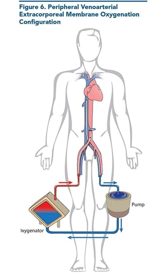 🏥🚨🚨Avances en la reanimación cardiovascular en el servicio de urgencias.⚕️
👇👇👇👇europepmc.org/article/med/35…
👇👇👇👇👇👇
acrobat.adobe.com/link/track?uri…