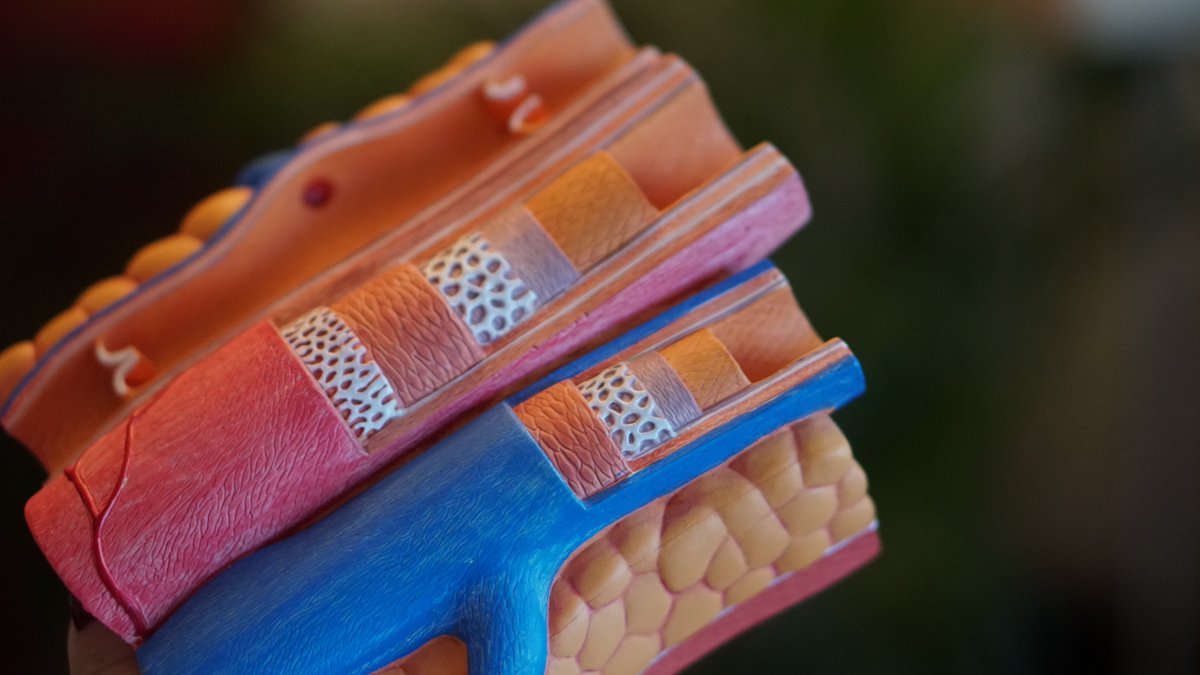 'What Are the Early Warning Signs and Symptoms of a Clogged Artery?'

feedkast.com/feeds/759

#Cardiology