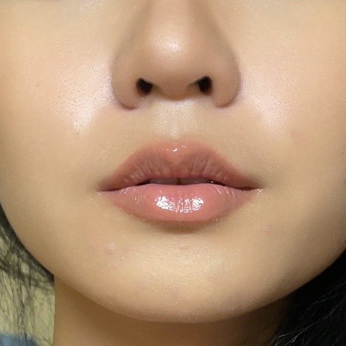 SowonClinic's tweet photo. ก็ปากฉ่ำ ฟู อิ่มไปเลยสิค่า👄😘
แค่ #ฟิลเลอร์ปาก คือปังไม่ไหว

ดูรีวิว #ลูกสาวโซวอน #รีวิวโซวอน #โซวอนคลินิก https://t.co/dGdetJKo2G
