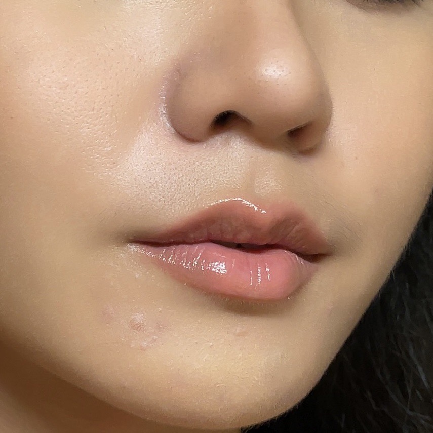 SowonClinic's tweet photo. ก็ปากฉ่ำ ฟู อิ่มไปเลยสิค่า👄😘
แค่ #ฟิลเลอร์ปาก คือปังไม่ไหว

ดูรีวิว #ลูกสาวโซวอน #รีวิวโซวอน #โซวอนคลินิก https://t.co/dGdetJKo2G