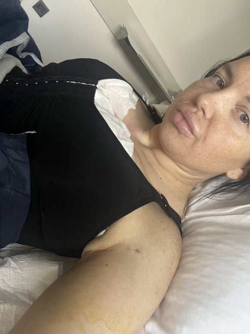 Brust Op &uuml;berstanden (450cc) https://t.co/PduA8cGzau<a href="/tag/stripchat"class="tags"><span>#stripchat</span></a><a href="/tag/stripchatlive"class="tags"><span>#stripchatlive</span></a>