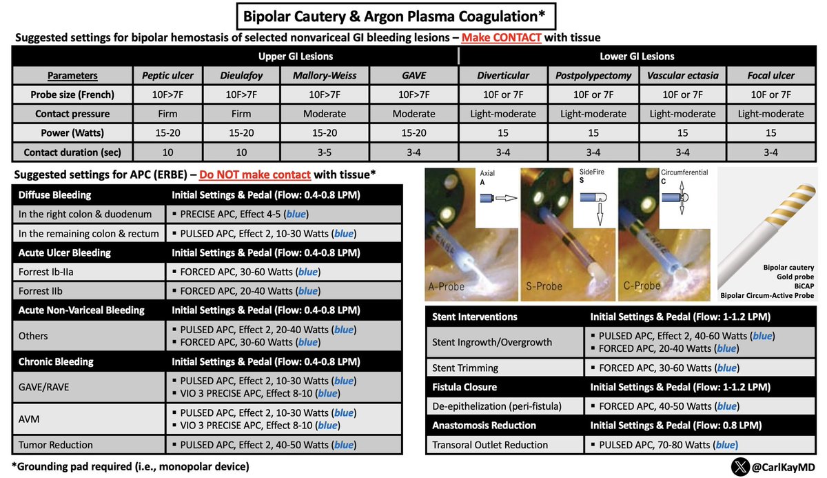 SAUSHEC_GI's tweet photo. Bipolar Cautery &amp; Argon Plasma Coagulation (APC)

▪️BICAP = bipolar, needs contact
▪️APC = monopolar, no contact
▪️APC requires grounding pad
▪️BICAP: know settings based on dz
  🔺Probe size
  🔺Contact pressure
  🔺Power
  🔺Duration
▪️Many uses for APC
  🔺Power, Flow, Effect https://t.co/PNFJFUFUXX