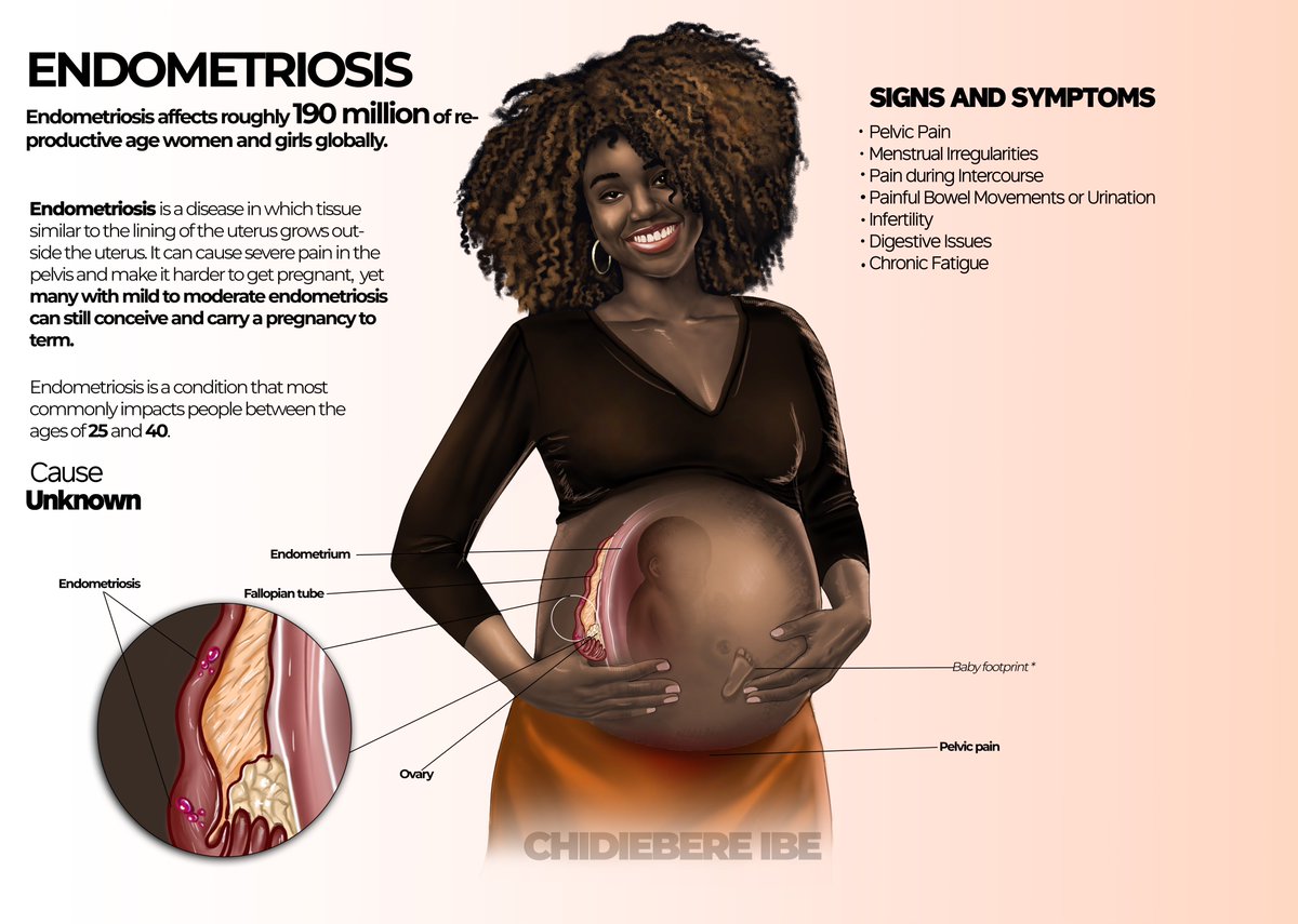 Endometriosis has long been wrongly perceived to be rare among women of African descent. The misconception about the prevalence of endometriosis among African women has significantly contributed to long diagnostic delays, and care, and a scarcity of research on the condition