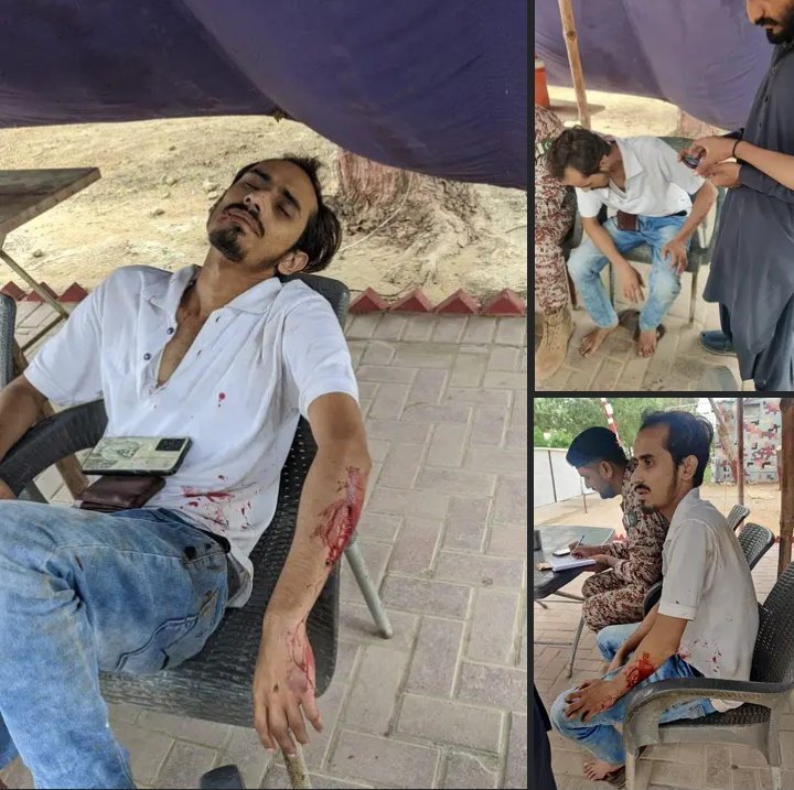 ڪراچي يونيورسٽي ۾ سنڌي شاگردن مٿان جمعت عرف دھشتگرد تنظيم  البدر جو بهيماني تشدد جي مزمت ڪيون ٿا ڪراچي جا امير حافظ نعيم  پنهنجي ڇاڙتن کي لغام ڏي ائين نه ٿيي جو اوهان به سنڌ ۾ ڪٿي گهمي نه سگهندا
#JamatDhshtgardTanzeem