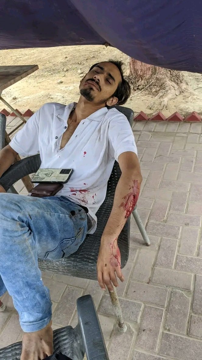PrsfK's tweet photo. Karachi University is once again witnessing the terror of Jamiat, as a Sindhi student belonging to Sindhi Shagird Sath has been beaten to the point of hospitalisation. With the administration of Karachi University once again turning a blind eye as always to the thuggery of Jamiat https://t.co/xPZGIQ9x9d