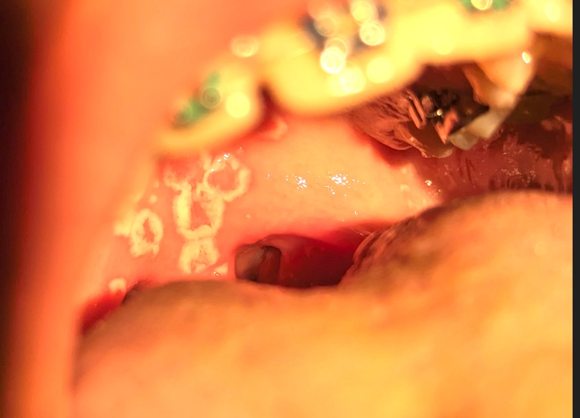 Fraslin's tweet photo. #DocToc étudiants en médecine. Votre diagnostic chez un enfant de 12 ans ? https://t.co/B3wh5kzR1n