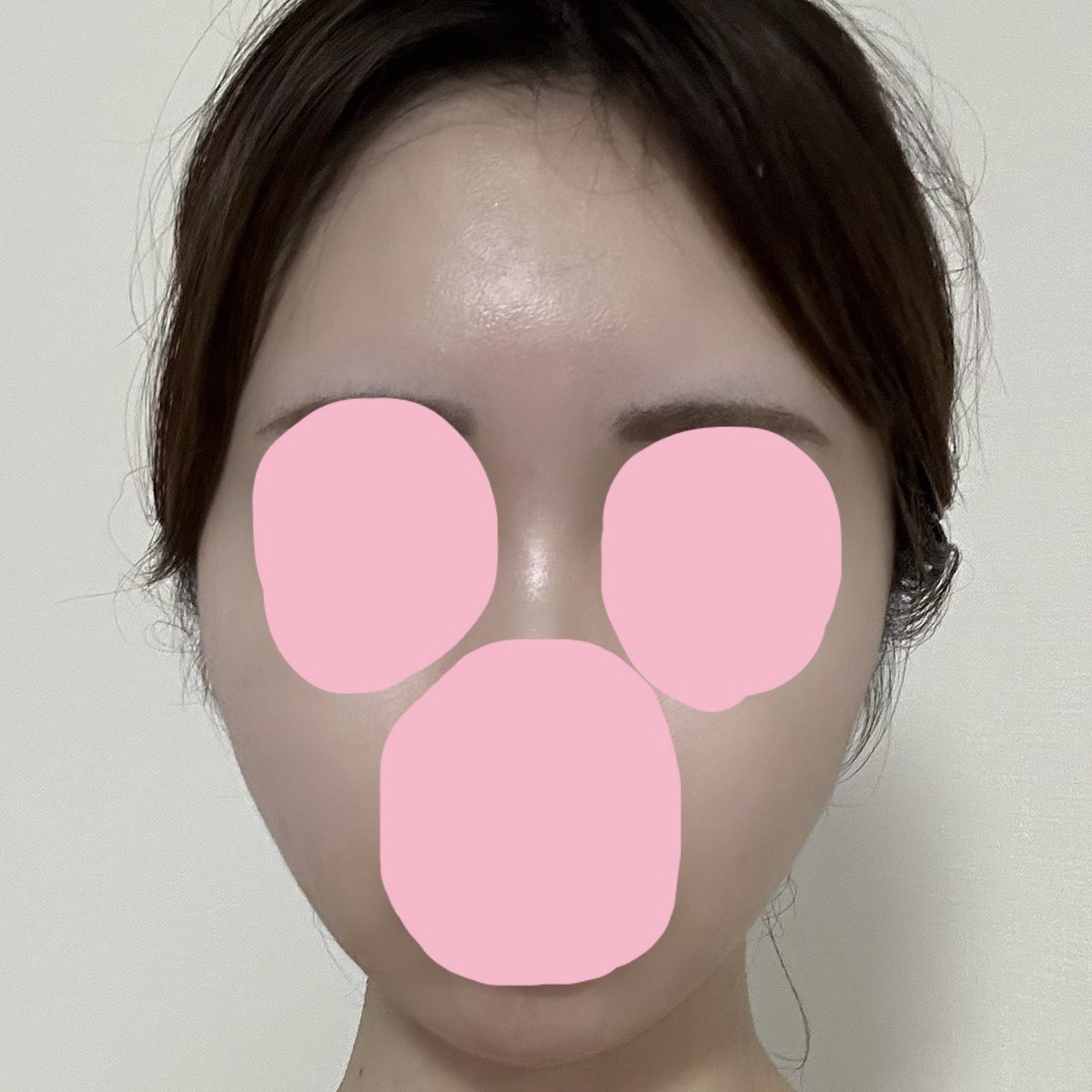 szyoon_2's tweet photo. 輪郭変わりすぎて親から骨切り疑われてるwwwww https://t.co/VDYy5noZbt