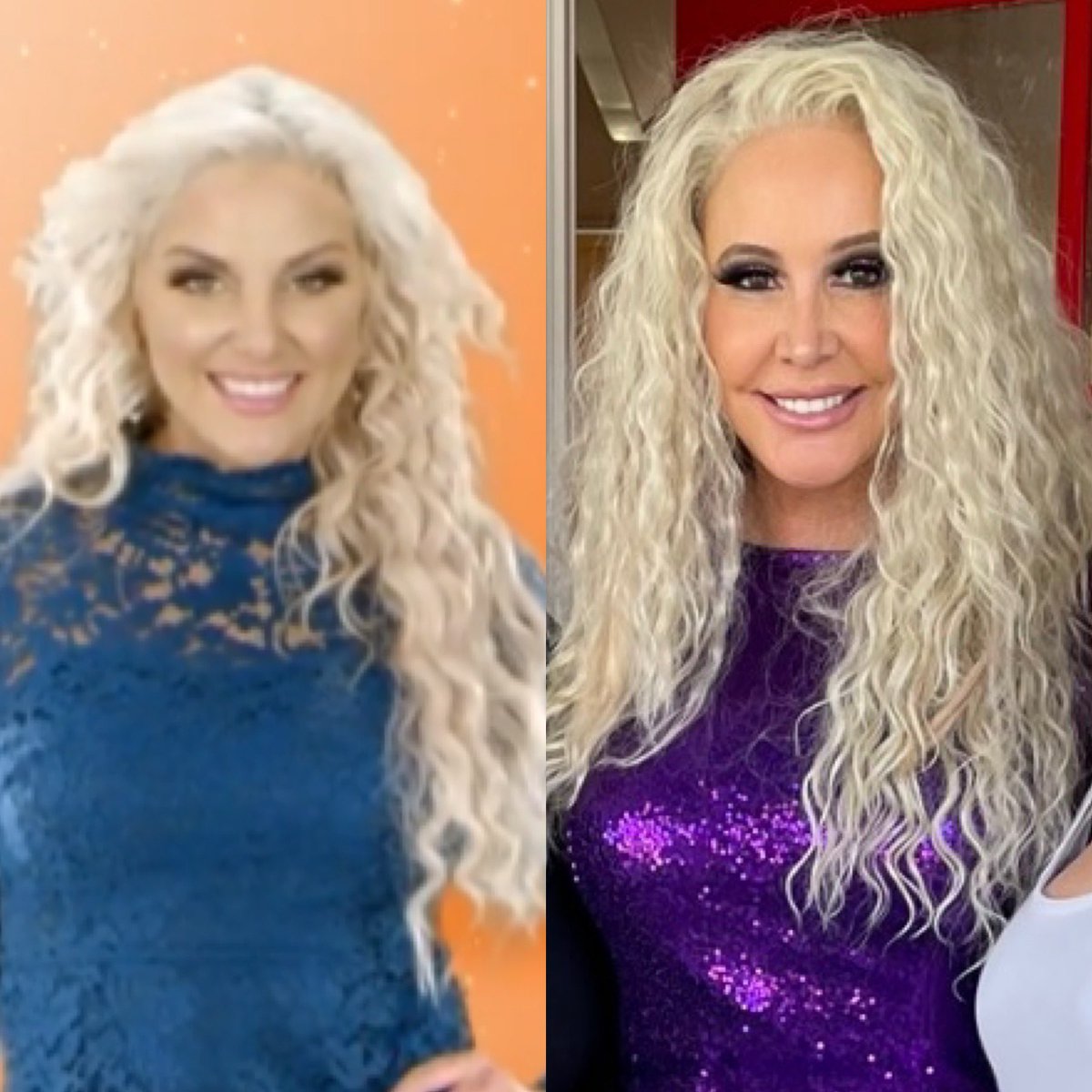 Is Shannon Beador Pregnant Again Or Just Weight Gain? Is Shannon Beador Pregnant Again Or Just Weight Gain?