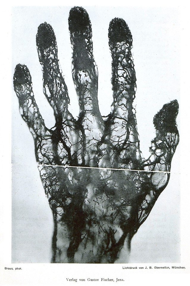 An X-ray image of the blood vessels of the hand made using mercury injection (1896)