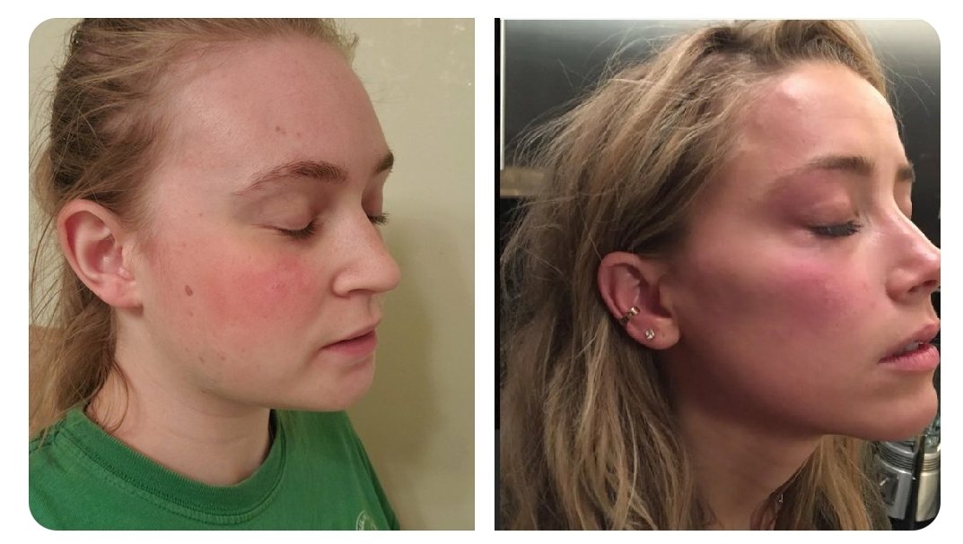 Izze 🦁🐻 tweet media