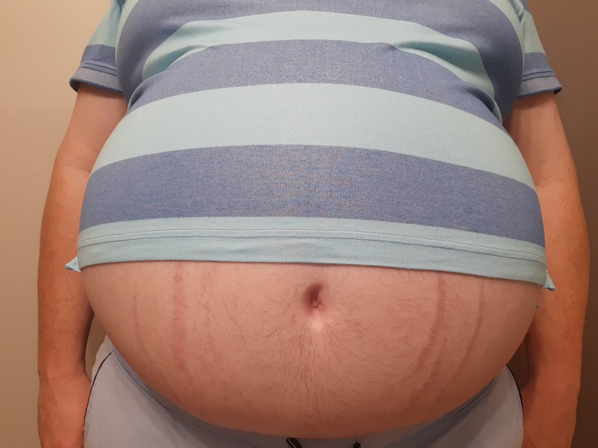 EpiTaph18645687's tweet photo. Sheeeeesh! Pushed myself to the absolute max with inflation! Check out my Patreon! https://t.co/0RHlYroAFN #bellyinflation #bigbelly #weightgain #gainerbelly #ballbelly #grommr #ballgut #bloated #stuffedbelly #mpreg #mpregbelly #howtogainweight #bloatedbelly https://t.co/D8utExjvXj