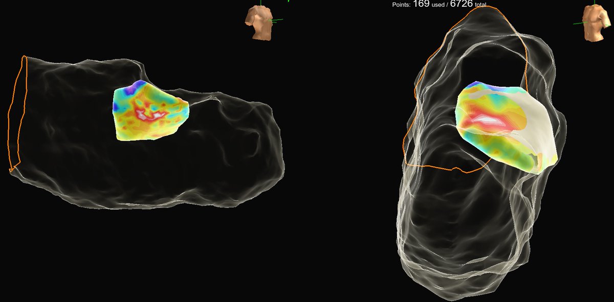 Jason Blohm tweet media