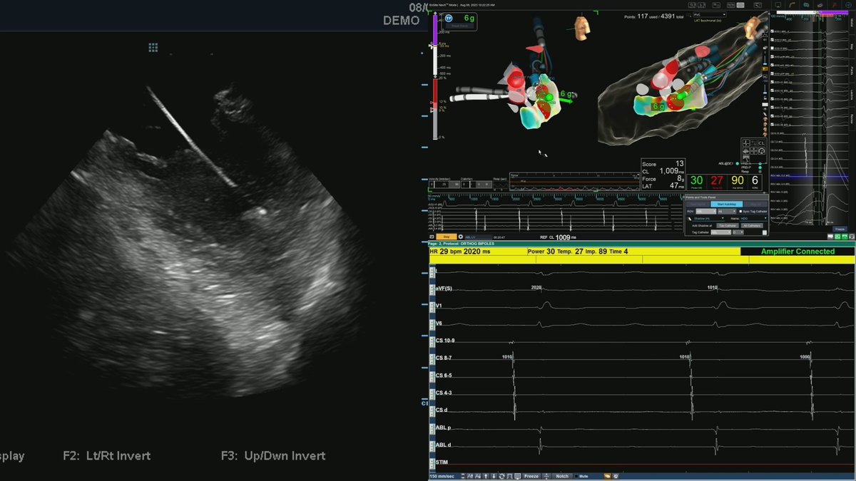 Jason Blohm tweet media