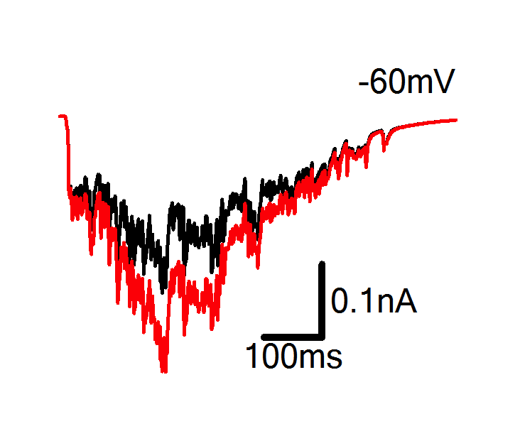 KiraPoskanzer's tweet photo. ephys https://t.co/gA2R3OQ3I0