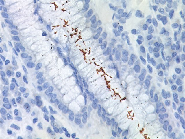 preposterjohn's tweet photo. Holy Pylori Batman! https://t.co/Ti33f7k9wH @IDSAMedEdCOP @CDC_NCEZID 
@AHNidccm @NurseStandard @mnnurses @myamericannurse @ANANursingWorld @NurseGroups @IDSAInfo @NatRevGastroHep @AmerGastroAssn @WCGIC @Interna36446420 @GIreview @NMGastro https://t.co/v8ON1spGQT