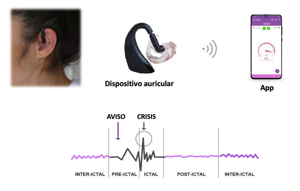 📣 Muy contentos de participar en el estudio #SERAS-HOME‼️ 🔜 Empezando el reclutamiento

🧬Objetivo: validar dispositivo IA que detecta y avisa antes de las crisis epilépticas

🙋🏽‍♀️Más herramientas para mejorar la calidad de vida🔝 de las personas con #epilepsia💊

💪🏽💪🏽Seguimos!