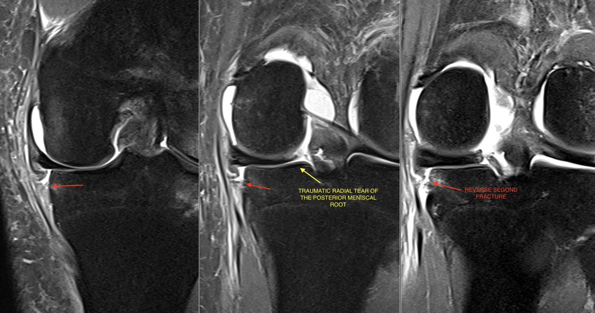 Alexeys Perez tweet media