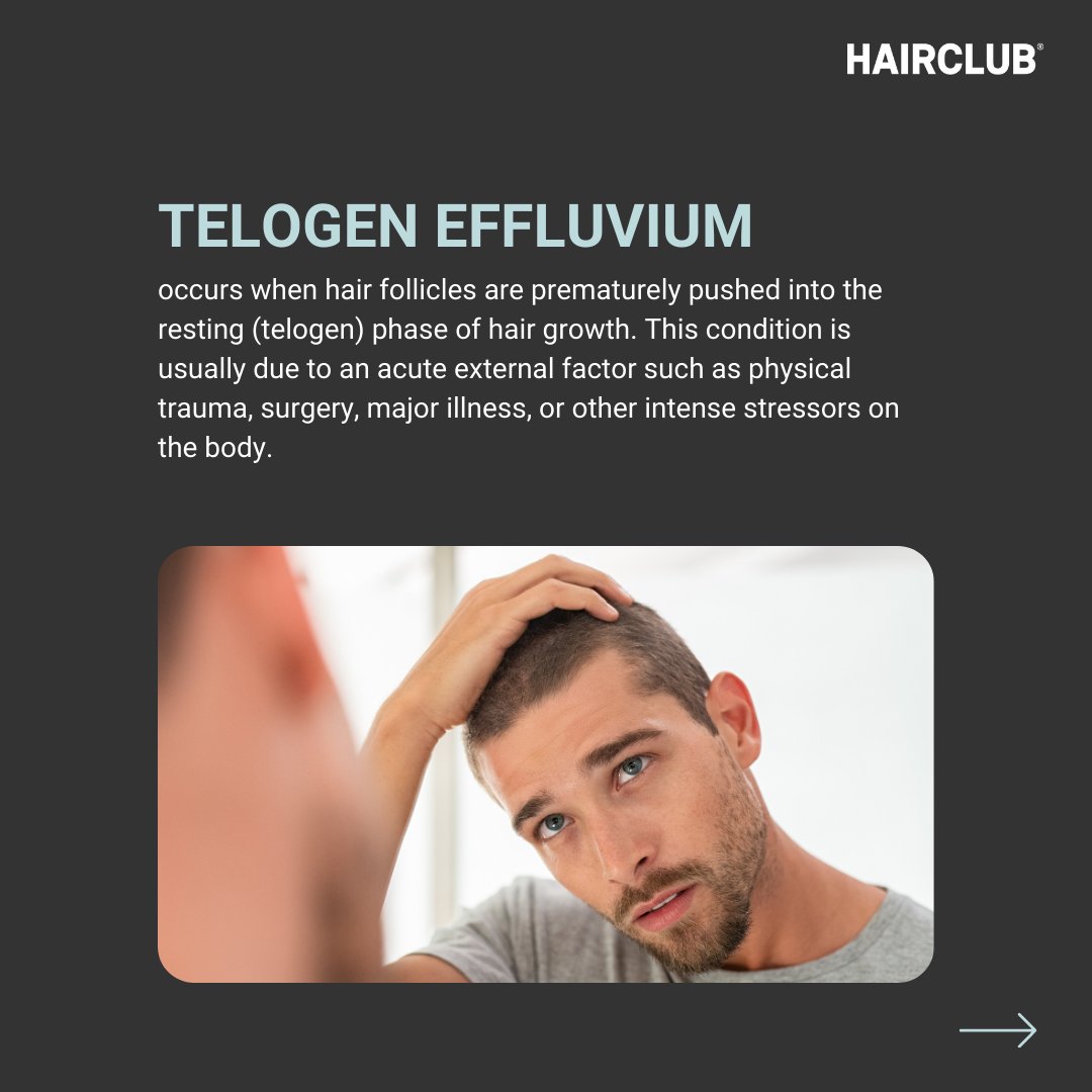 Empowering individuals on their unique hair loss journey. 🤍 We are dedicated to providing support and expert solutions for various hair loss conditions. 🌟 Book your free consultation at HairClub.com! #hairclub #hairloss #hairlossconditions #hairlosssolution
