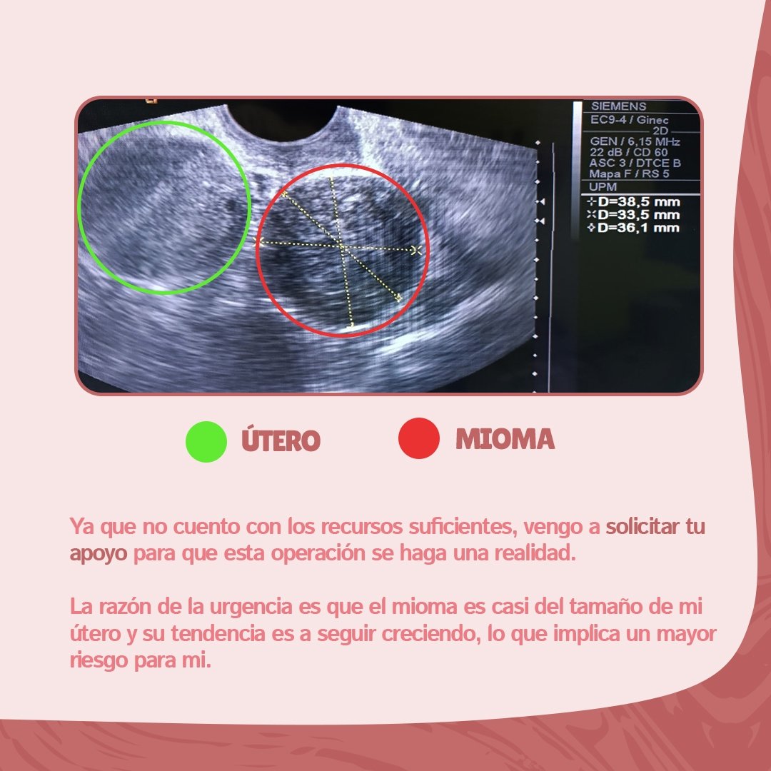 Go_Miguel's tweet photo. Hola, Dios te bendiga. Mi esposa está necesitando una operación y estamos recaudando fondos para lograrlo 🙌🏾 Sus oraciones, el compartir la info o apoyarnos financieramente será enormemente agradecido 🙏🏾 https://t.co/X3o5sh7x3p