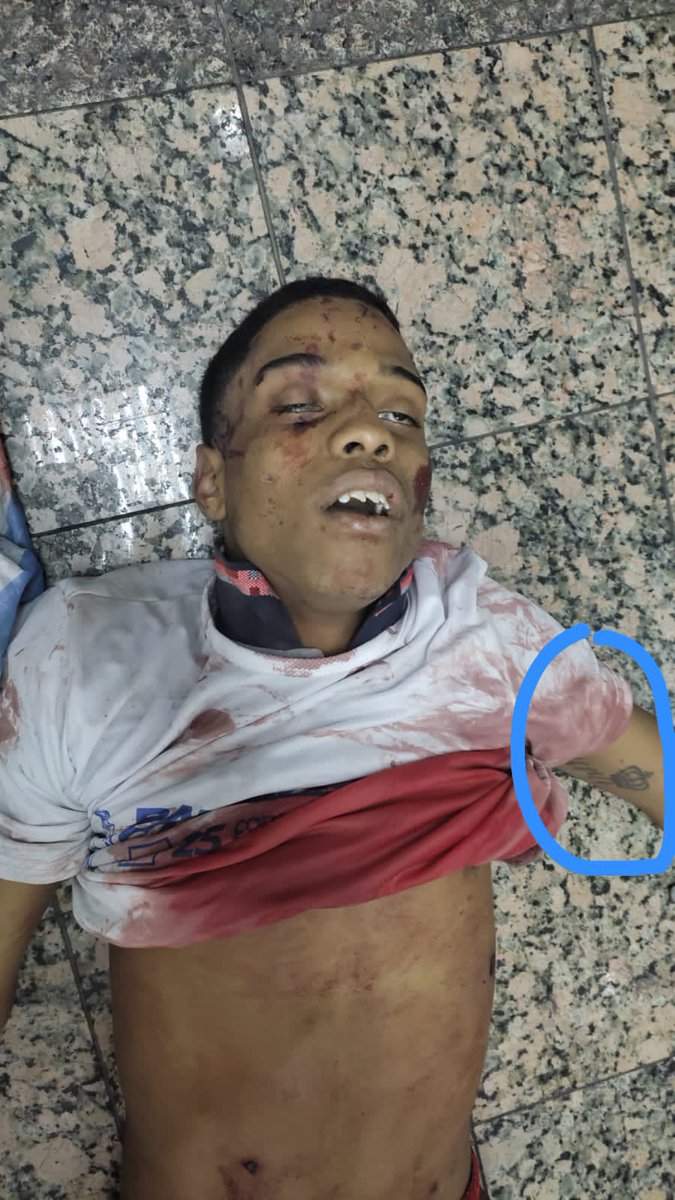 SamuelE52598824's tweet photo. 🚨🐀😡🇪🇨🚨
#URGENTE
EL SICARIO DE VILLAVICENCIO FUE ASESINADO DENTRO DE LA @FiscaliaEcuador @unidaddeflagrancia LO QUISIERON CALLAR Y LO CALLARON.... https://t.co/JJEsf8wu8o