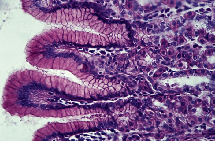 DiabetesLabIBGM's tweet photo. Un estudio publicado en @NatureRevEndo ha desarrollado una nueva técnica para conseguir células productoras de insulina a partir de células madre humanas del estómago.
@SEDiabetes @ciberdem 
📰https://t.co/lmRTZ8enRO https://t.co/ylffqE8HTR