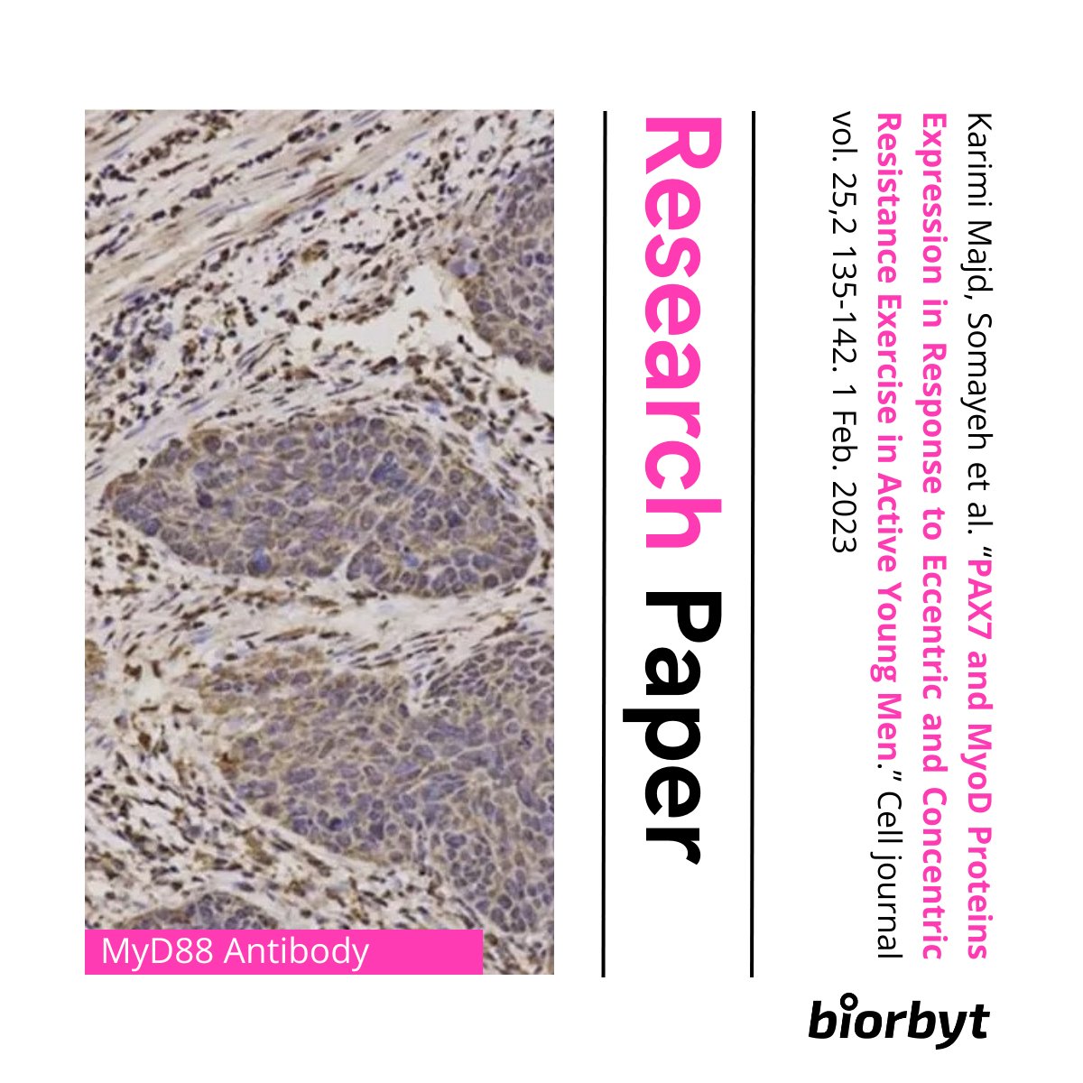 🔍🔍Research Paper: Another example of one of the thousands of published research papers by Biobyt's partners. In this case, on the subject of muscle regeneration.

Find the full article here: ncbi.nlm.nih.gov/pmc/articles/P…

#research #laboratory #lifesciences #bioscience #antibodies
