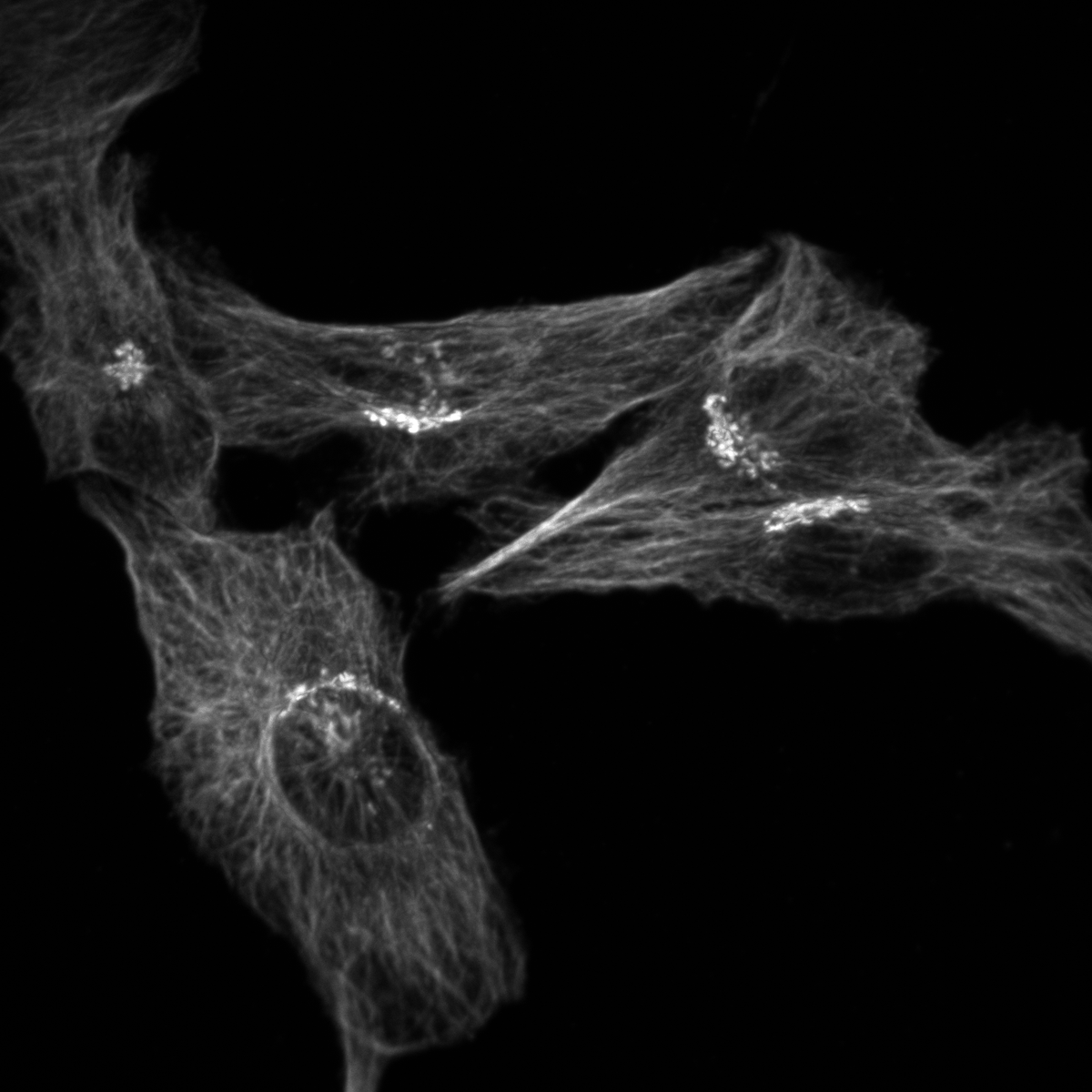 psychescope's tweet image. Hi science twitter 👋
Do you test your mouse secondaries? I am looking for a reliable source of mouse secondaries for IF that don&apos;t cross react with rat, any recommendations? 
#Microscopy 
Pictured: goat anti-mouse secondary binding mouse anti-GM130 (golgi) and rat anti-tubulin