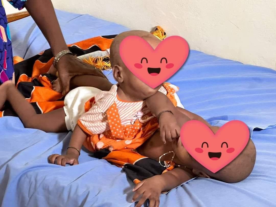 UCAD_Senegal's tweet photo. Séparation de deux soeurs siamoises à #HEAR âgées de 11 mois 
L'intervention chirurgicale de 3 heures, a eu lieu ce mercredi 9 Août 2023
Elle a été réalisée par l’équipe chirurgicale et anesthésique dirigée par Pr Gabriel Ngom
Félicitations!
#ucad #compublique #kebetu @infomedsn https://t.co/61TNvOV9kT