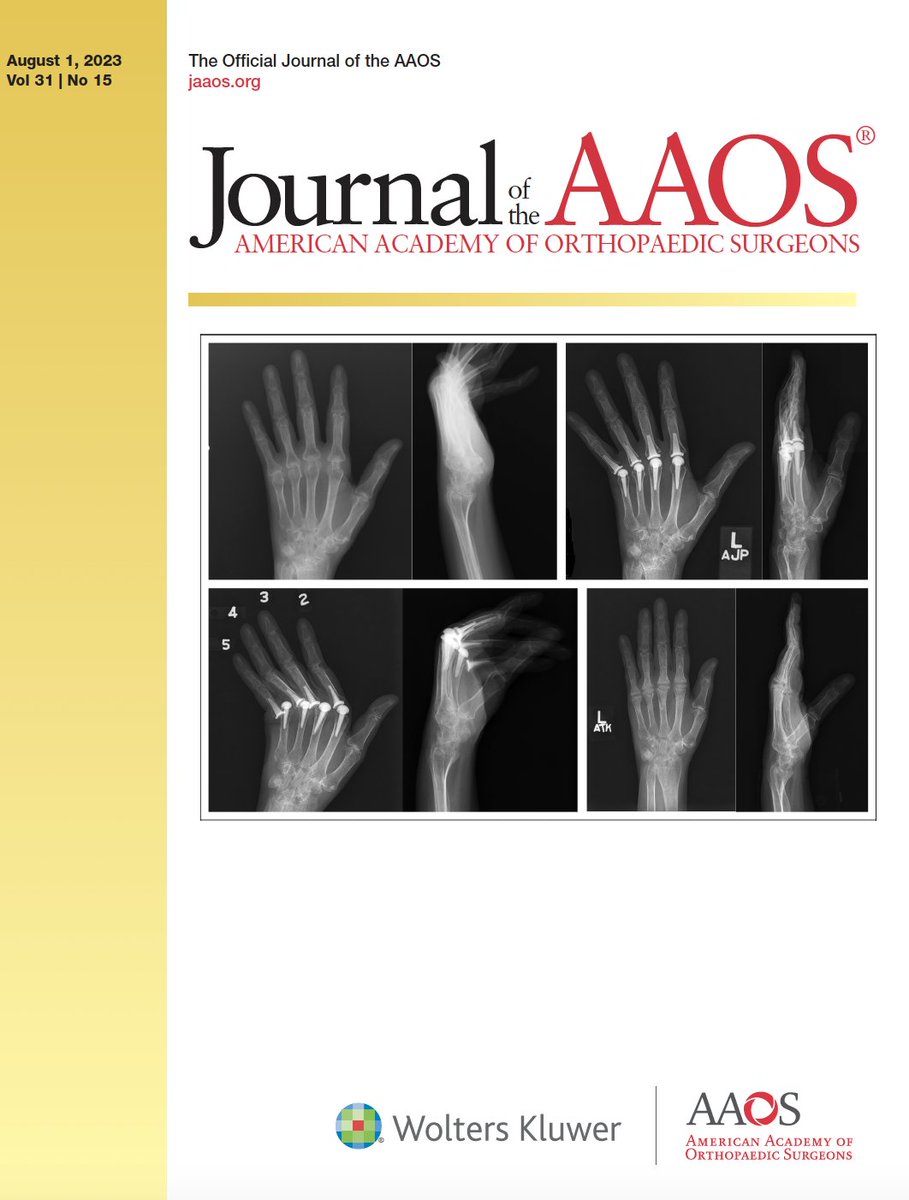 Last few days to read these FREE articles published in this special issue of JAAOS! 
Access ends 8/14. 
1⃣ Midcarpal Instability (MCI) is a relatively poorly understood condition and poses challenges to its diagnosis & management. 
More: ow.ly/gVhR50PqJaF @AAOS1