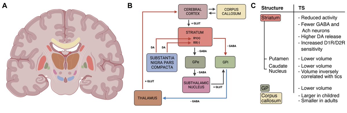 LabBnc's tweet photo. A new #review paper by @jacopolamanna,
@sara_spad et al. outlines #brain structural and functional changes in #Tourette syndrome! Check this out at Behavioral Sciences → https://t.co/FVYjzQmvfn
 @MDPIOpenAccess #neuroscience #Psychiatry #Tics #Tourettes #TouretteSyndrome #TS https://t.co/yXUU0609Mz