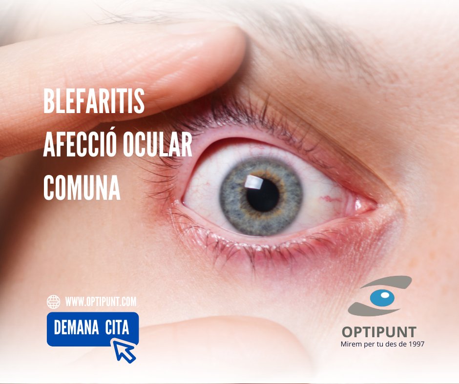 Optipunt tweet media