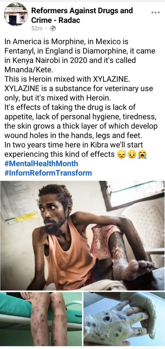 IsmailNjoroge1's tweet image. I&apos;m a REFORMER who used hard-drugs, now I&apos;m out here to preach the word of Reform.
#SaveTheYouths
#InformReformTransform
#NACADA