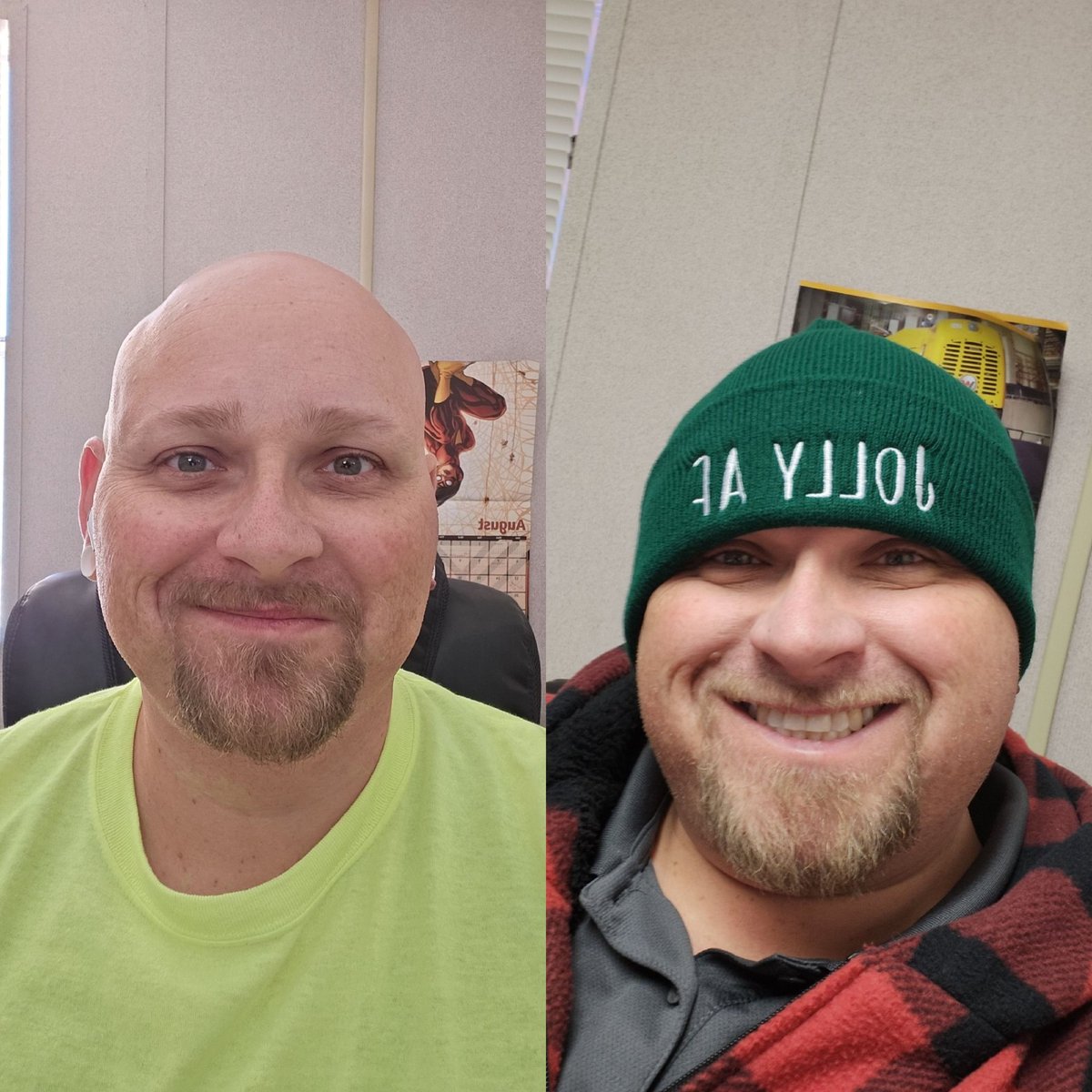 Joey_Gunnz_tv's tweet image. A little 6 weeks post-op transformation Thursday. My face has changed so much that it's crazy. This surgery has been a true life changer. I wanted to share with my Twitter fam 🧡🧡🧡 #transformationthursday