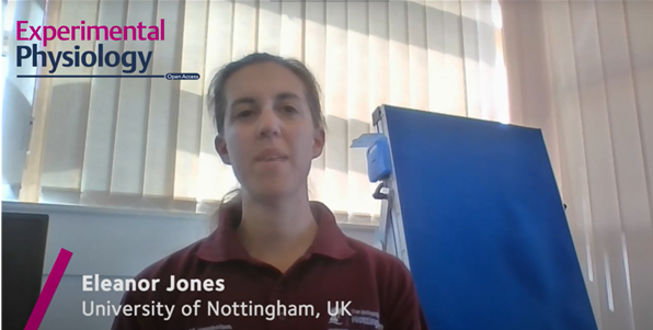 ExpPhysiol's tweet photo. Our latest #EPicks is now available!
@EleanorJones12 (@UNAD_Research) shares her research into acute adaptation of motor unit features to exercise-induced fatigue differs with types of loading!
🎥https://t.co/9OUjHjxEuk 
Read the article here👉https://t.co/tWNUH60med https://t.co/auxnTS90wv