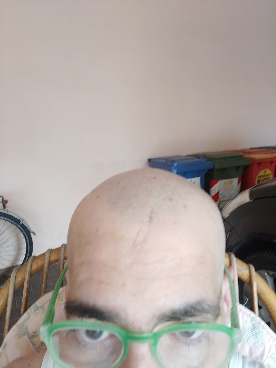 TommyVicenza's tweet photo. Rasatura fatta, che fresco ora 😂😂😂 #Capelli #RasatiZero #Caldo #Barbiere #IlTop #BelliCapelli https://t.co/PIl0evV8P6