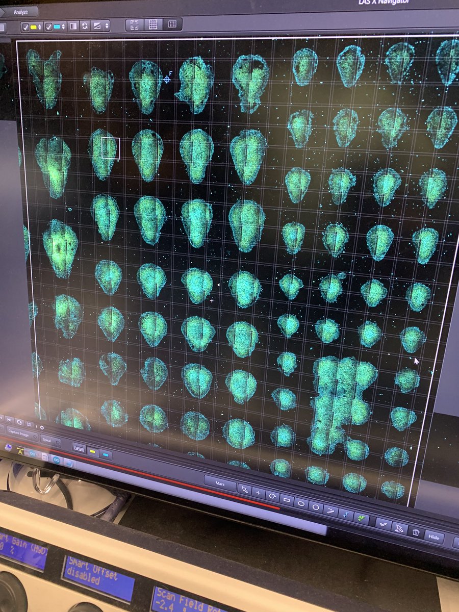 Day18 at #kitpqbio. Students in #teamsix produce massive amounts of micropatterned hESC symmetry breakers. Time-lapse imaging ongoing. Two weeks to go! @KITP_UCSB