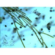 PhycoTechInc's tweet photo. Check out our image collection! Our USB Image library currently includes over 5,000 images representing 12 freshwater divisions and classes 

https://t.co/sN5iyRea0o https://t.co/J7rJtDMR3y