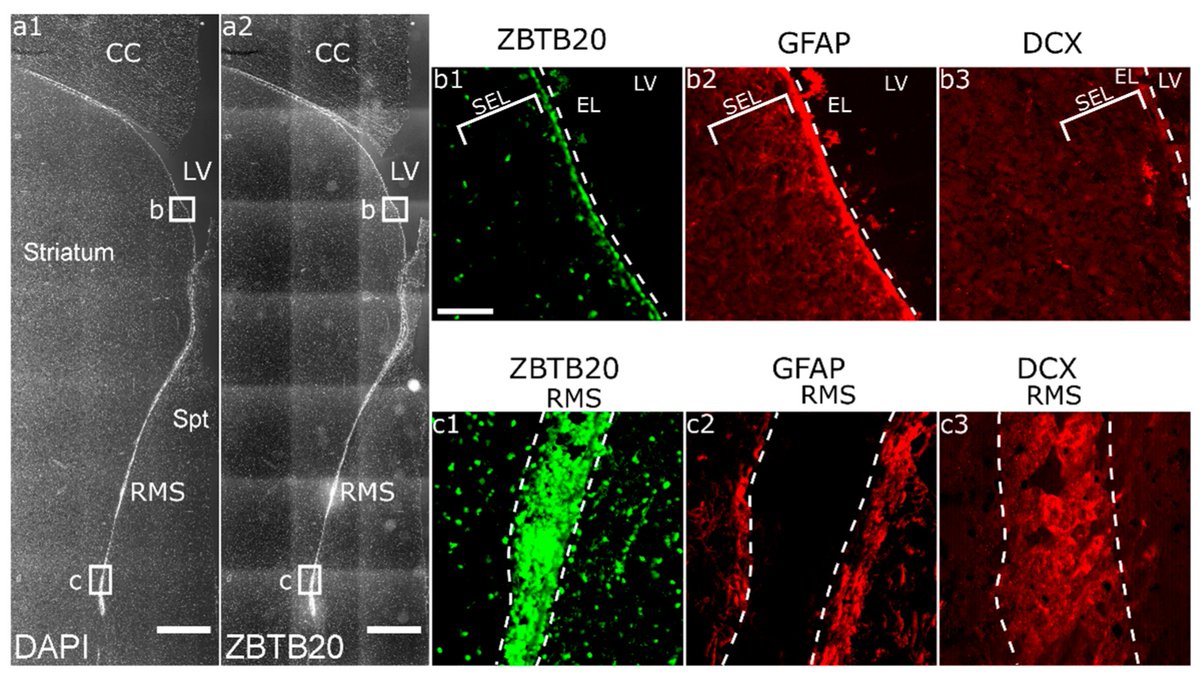 Results by Prof. Anton B. Tonchev et al. suggest that ZBTB20 expression is evolutionarily conserved in the mammalian neurogenic niche and is reactive to ischemia. This opens the possibility for further studies on its role in neurogenesis in primates: mdpi.com/2073-4425/13/9…
